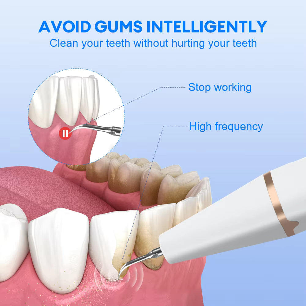 Ultrasonic Electric Dental Calculus Remover & Teeth Whitening Plaque Scaler with LED Light